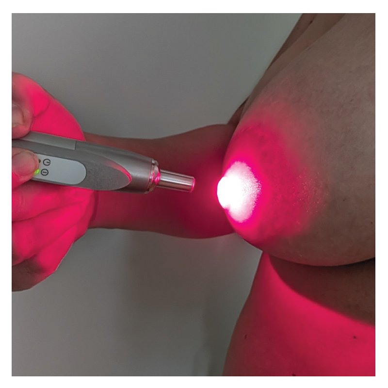 Ardo_Solardo_Low_Level_Laser_Bestrahlung_flaechig_800px